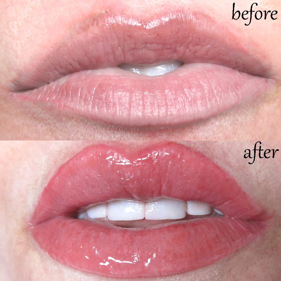 Opdatering Udfordring udstilling Aftercare Advice for Permanent Makeup Lips Treatments | Joli Visage  Skincare Clinic Blog
